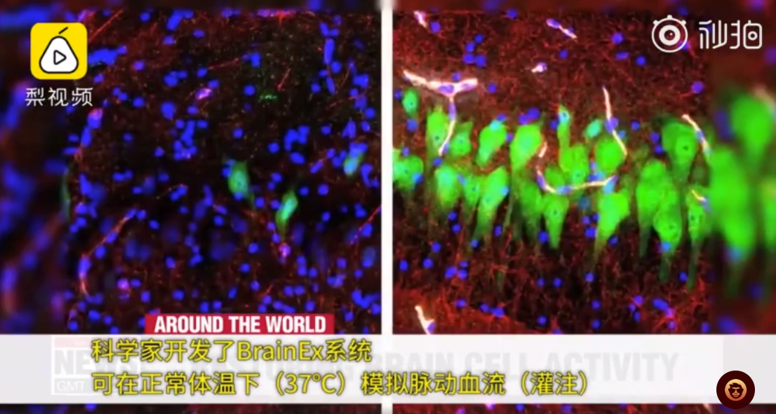 科学家成功复活死亡猪脑 “存活”长达36小时